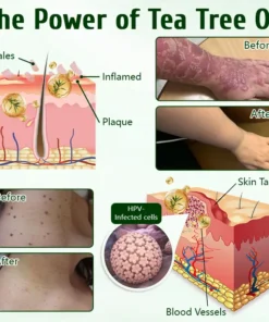 Timilk® DermaPure Tea Tree Healing Cream