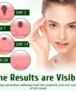 Timilk® DermaPure Tea Tree Healing Cream