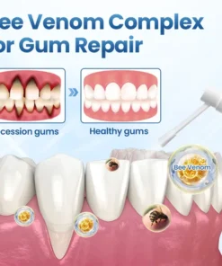 Timilk® GumRelief Natural Spray