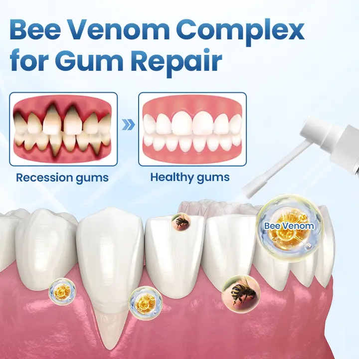 Timilk® GumRelief Natural Spray