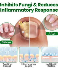 Timilk® HerbaNail 7-Day Repair Serum