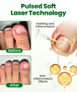 Timilk® HerbaNail 7-Day Repair Serum