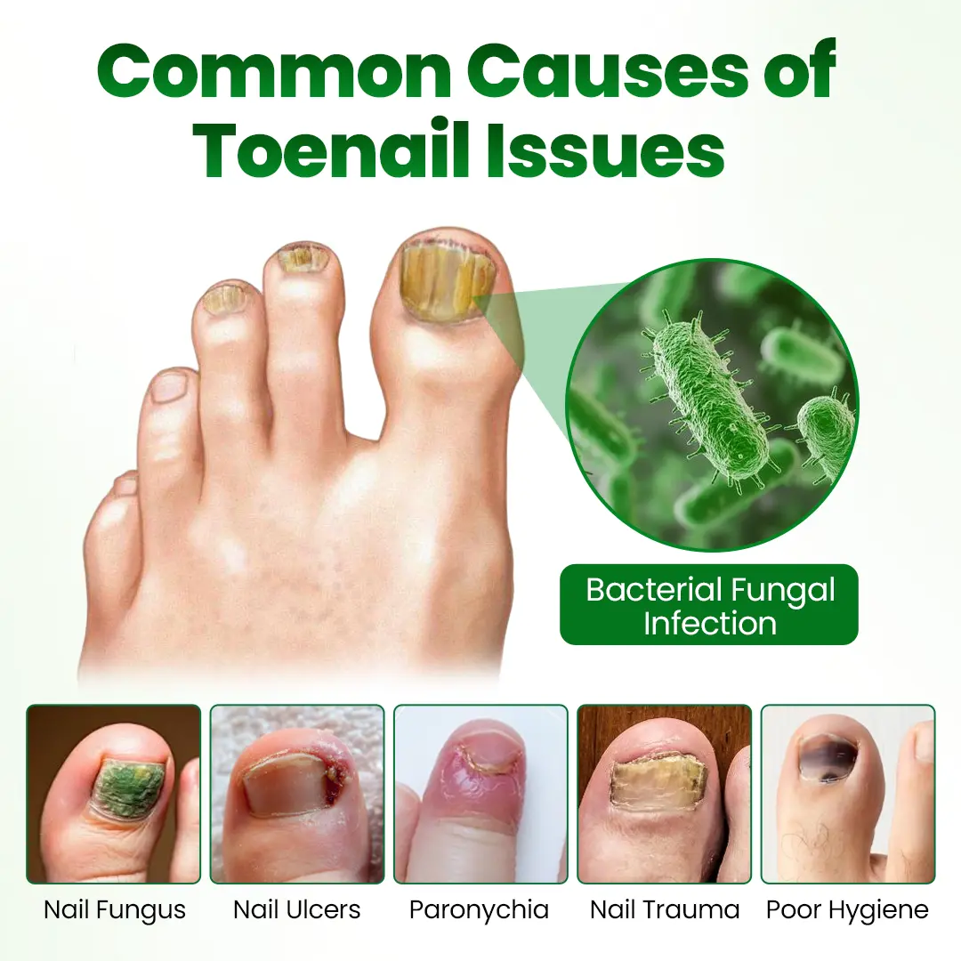 Timilk® HerbaNail 7-Day Repair Serum