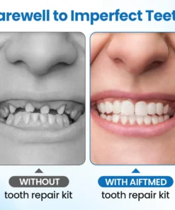 Timilk® SmileMend Tooth Repair Filling Kit