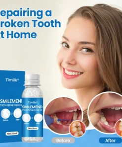 Timilk® SmileMend Tooth Repair Filling Kit