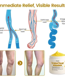 Timilk® VeinClear Bee Venom Cream