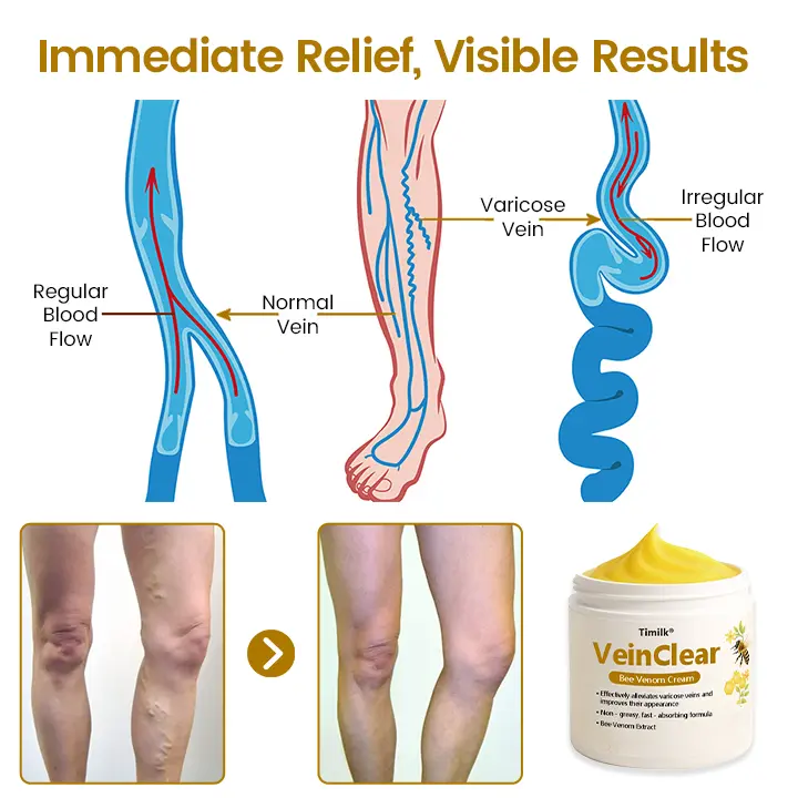 Timilk® VeinClear Bee Venom Cream