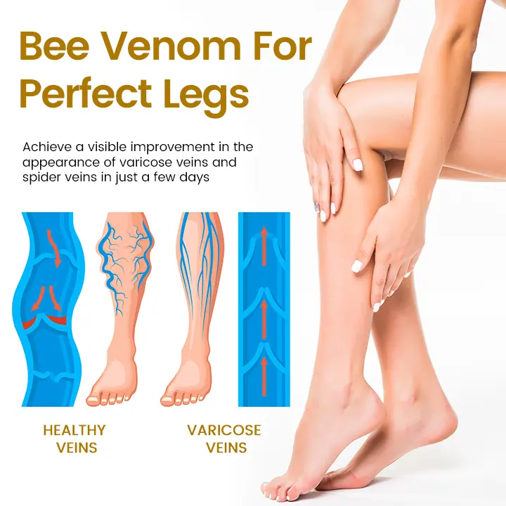 Timilk® VeinClear Bee Venom Cream