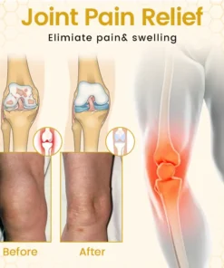 Timilk® VenomFlex Bee Therapy Cream