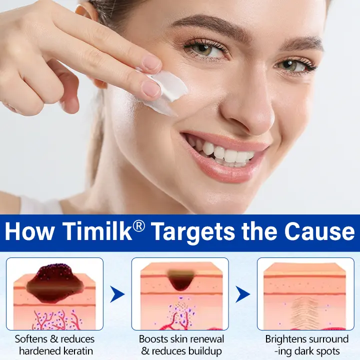 Timilk® WartClear Herbal Ointment