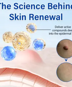 Timilk® WartClear Herbal Ointment