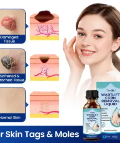 Timilk® WartLift Corn Removal Liquid