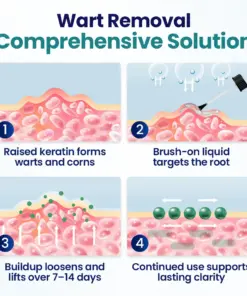 Timilk® WartLift Corn Removal Liquid