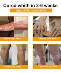 Vivireal® USP Bee Venom and Bioactive Peptides Multi-Effect Analgesic Oral Solution