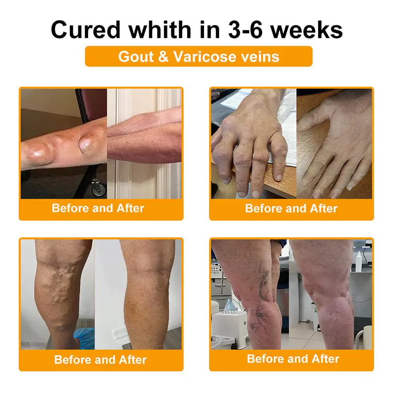 Vivireal® USP Bee Venom and Bioactive Peptides Multi-Effect Analgesic Oral Solution