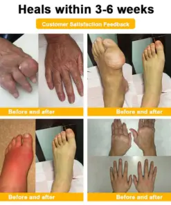 Vivireal® USP Bee Venom and Bioactive Peptides Multi-Effect Analgesic Oral Solution