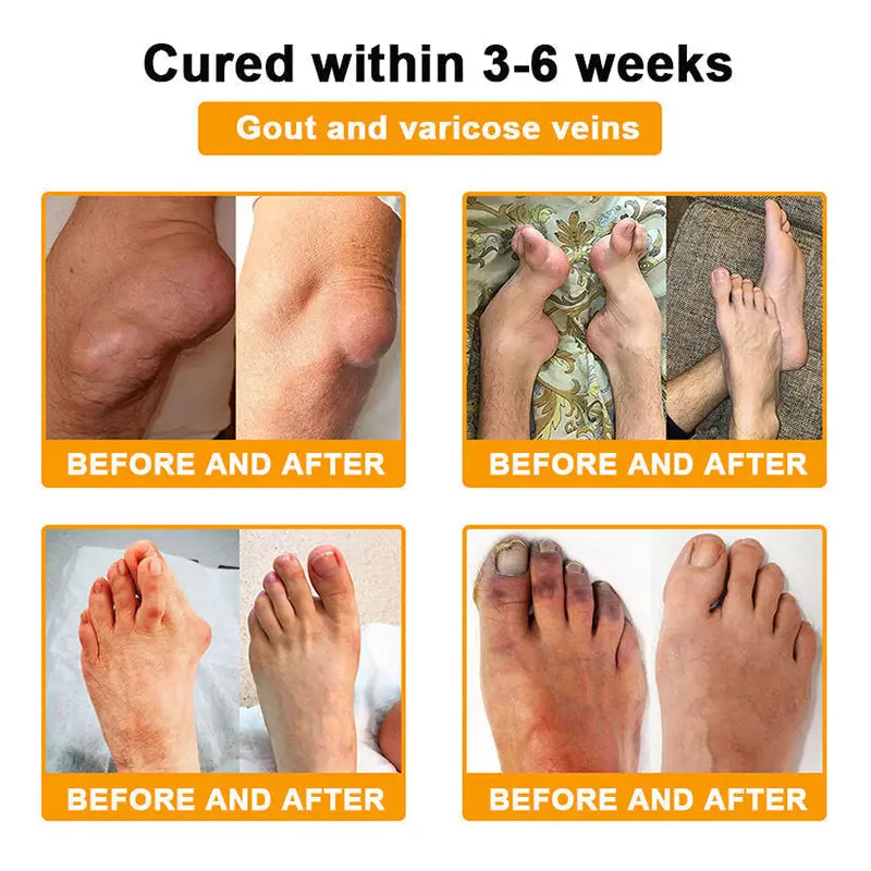 Vivireal® USP Bee Venom and Bioactive Peptides Multi-Effect Analgesic Oral Solution