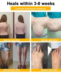 Vivireal® USP Bee Venom and Bioactive Peptides Multi-Effect Analgesic Oral Solution