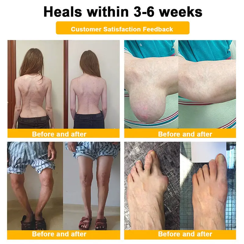 Vivireal® USP Bee Venom and Bioactive Peptides Multi-Effect Analgesic Oral Solution