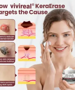 Vivireal®KeraErase Dual-Action Renewal Cream
