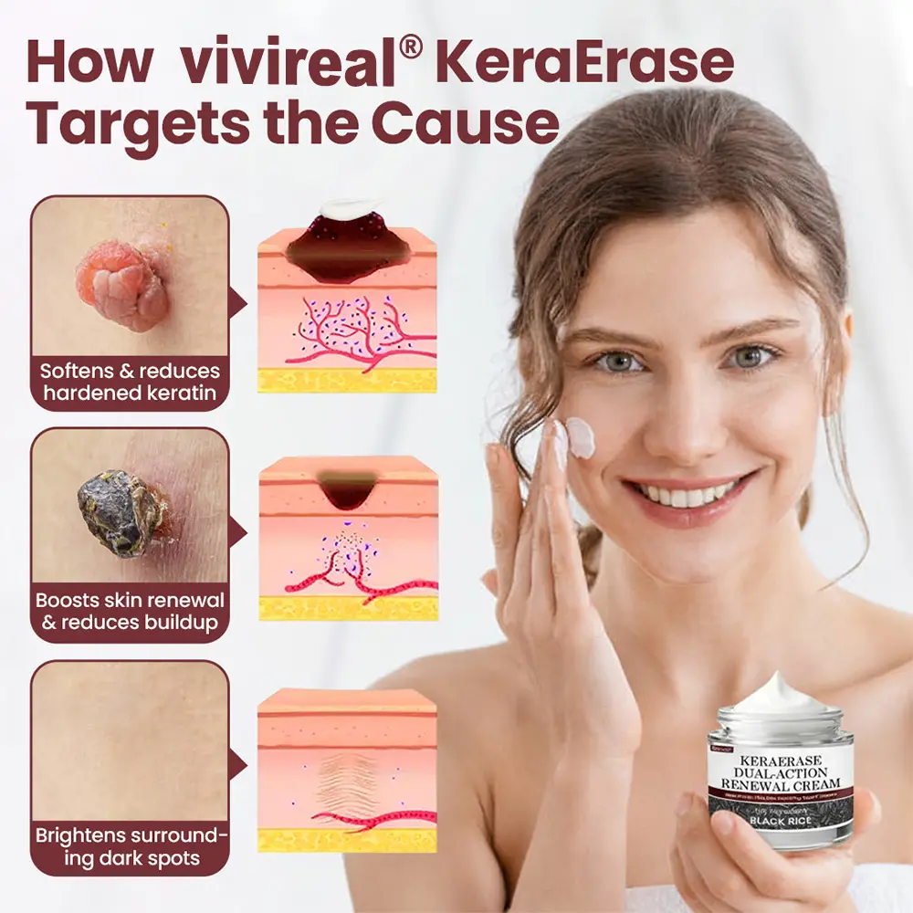 Vivireal®KeraErase Dual-Action Renewal Cream