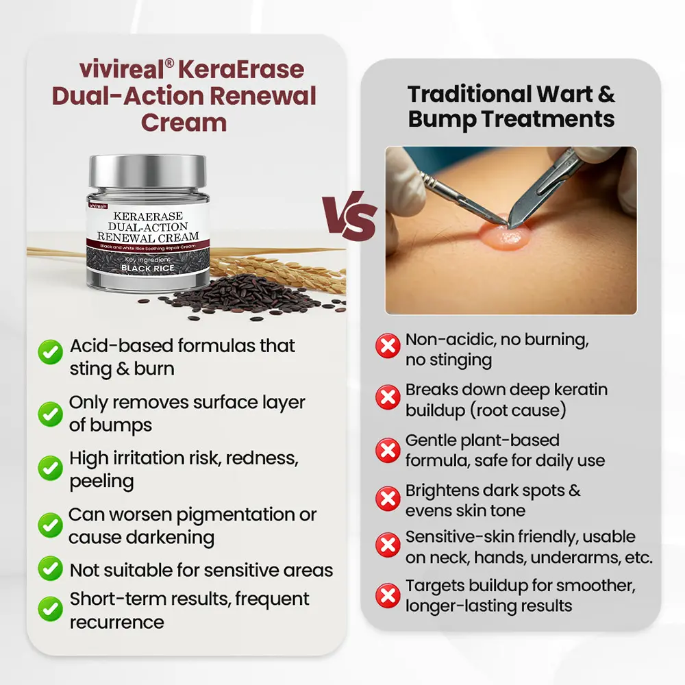 Vivireal®KeraErase Dual-Action Renewal Cream