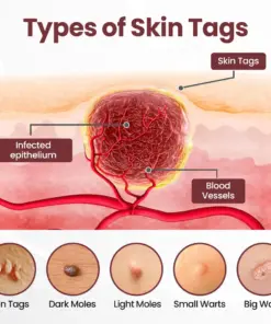 Vivireal®KeraErase Dual-Action Renewal Cream