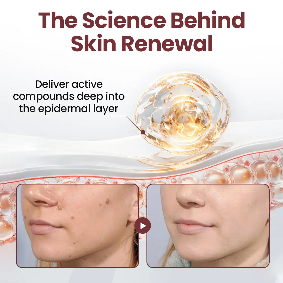 Vivireal®KeraErase Dual-Action Renewal Cream