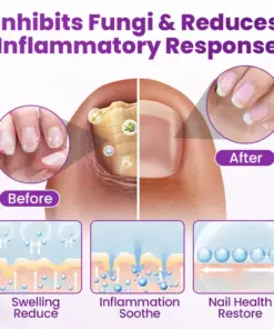 Timilk® AeroFilm Foot Defense Mist