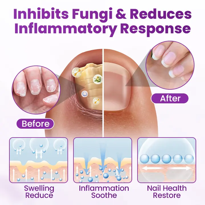 Timilk® AeroFilm Foot Defense Mist