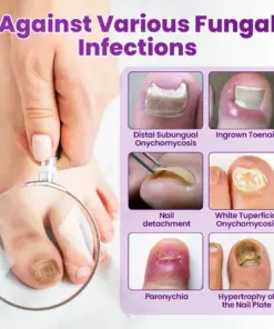 Timilk® AeroFilm Foot Defense Mist