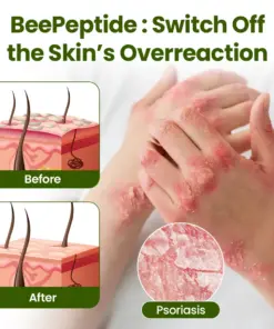 Timilk® BeePeptide RootSoft DualRelief Cream