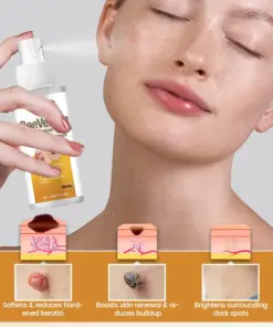 Timilk® BeeVenom Wart Renewal Spray