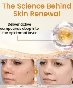 Timilk® BeeVenom Wart Renewal Spray