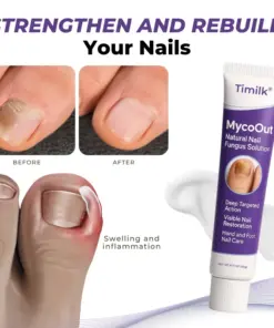 Timilk® MycoOut Natural Nail Fungus Solution