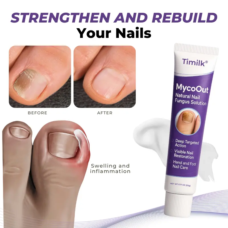 Timilk® MycoOut Natural Nail Fungus Solution