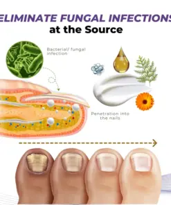 Timilk® MycoOut Natural Nail Fungus Solution
