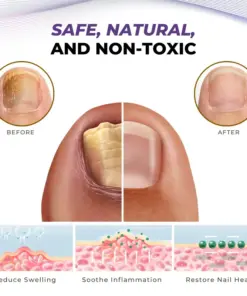 Timilk® MycoOut Natural Nail Fungus Solution