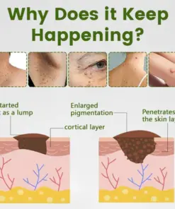 Timilk® ThujaClear Botanical Wart Cream