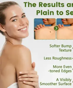 Timilk® ThujaClear Botanical Wart Cream