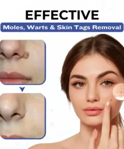 Timilk® VanishPro Skin Spot Removal Cream