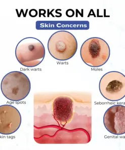 Timilk® VanishPro Skin Spot Removal Cream