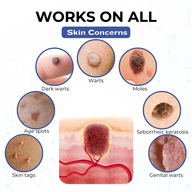 Timilk® VanishPro Skin Spot Removal Cream