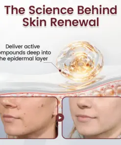 Timilk® BumpAway Gentle Renewal Cream