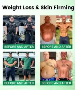 Timilk® Moringa · Berberine × NAD+ 10-in-1 Advanced Metabolic Nano Microneedle Patch