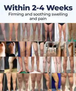 Timilk® SwellRelief Circulation Support Cream