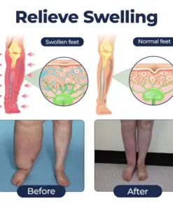 Timilk® SwellRelief Circulation Support Cream