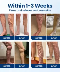 Timilk® VenoRelief Botanical Leg Spray