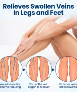 Timilk® VenoRelief Botanical Leg Spray