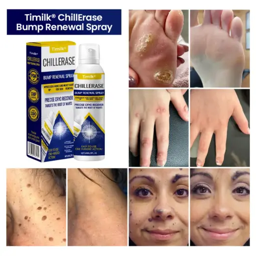 Timle Spray Timilk ChillErase® Bump Renewal Spray - Timilk